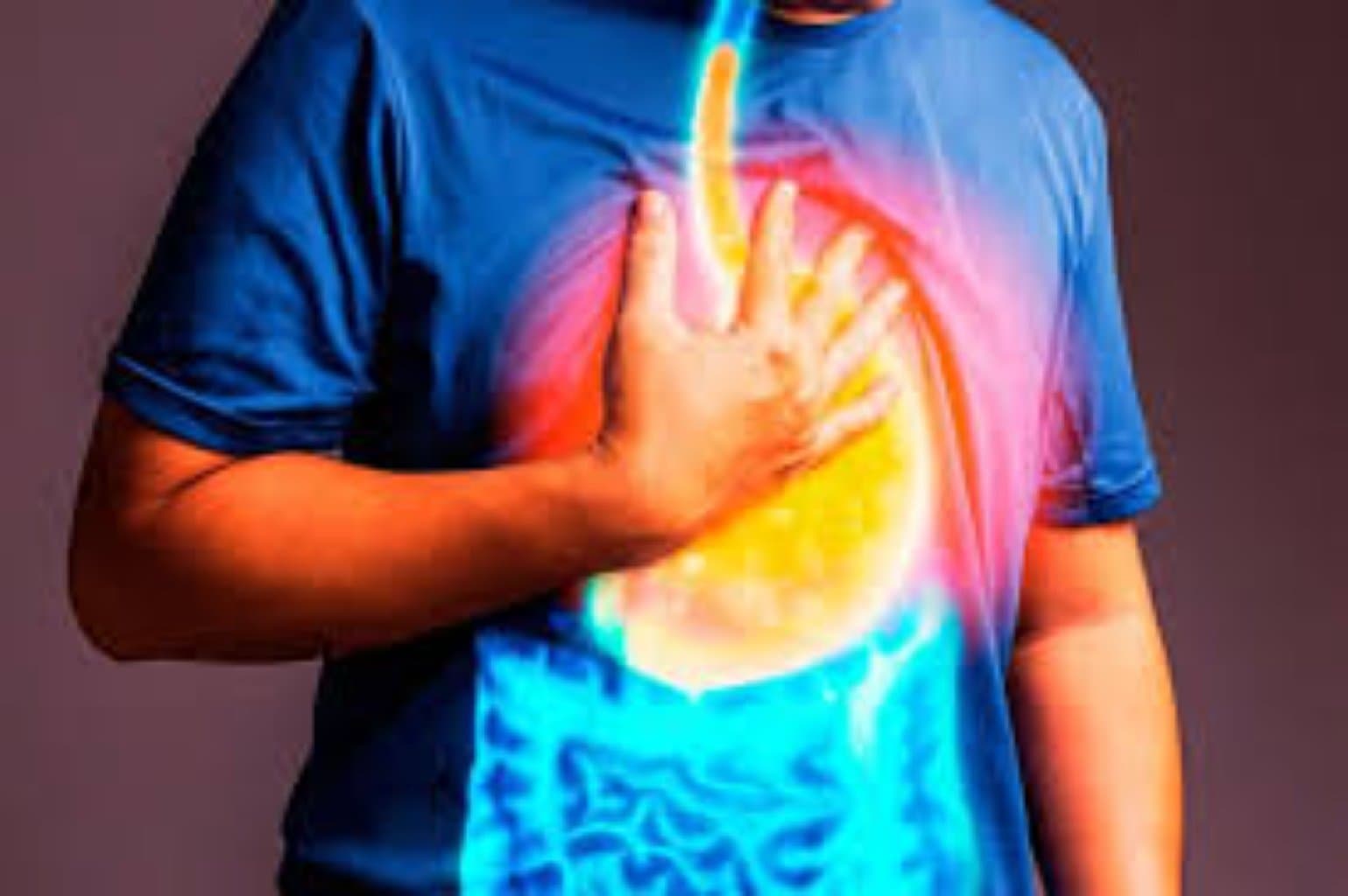 Özofagus Xərçəngi