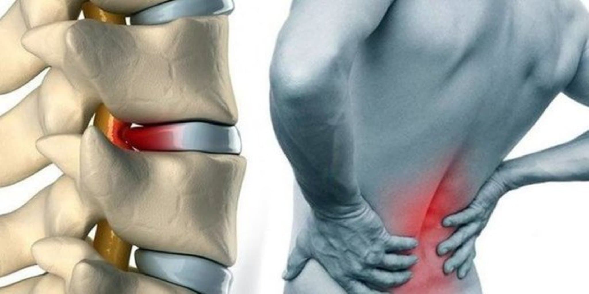 Anadangəlmə (kongenital) hipotireozun əlamətləri