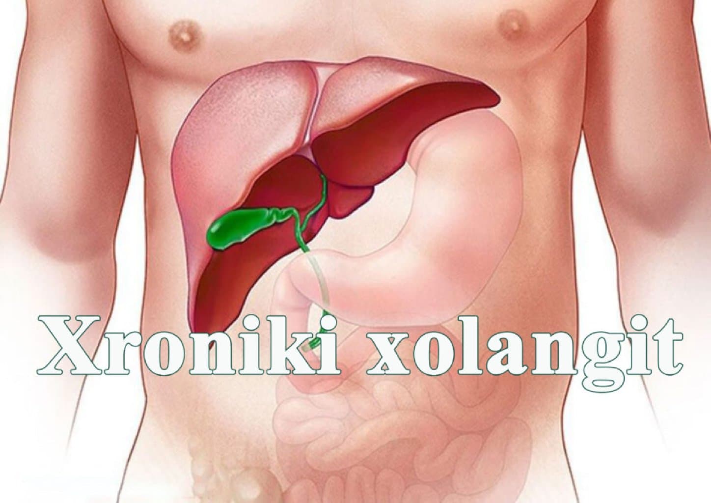 KƏSKIN XOLANGIT