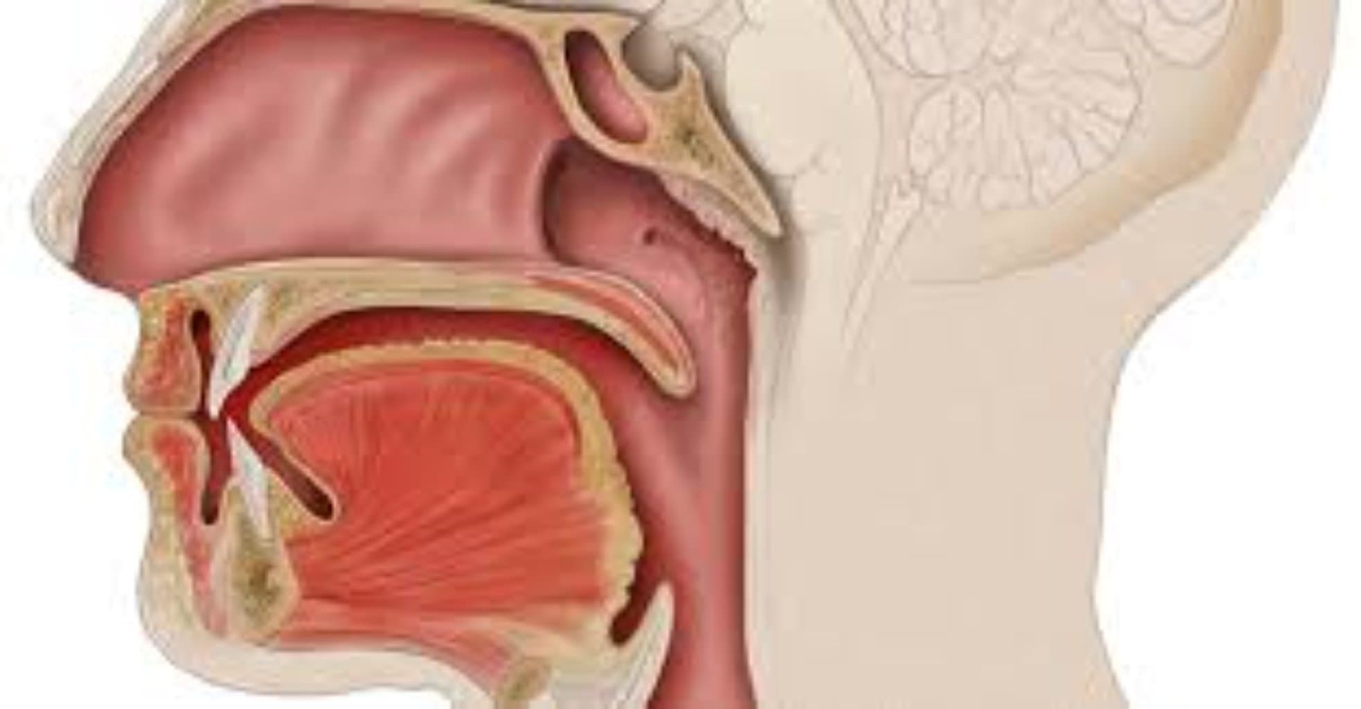 Acı ağız sindromu