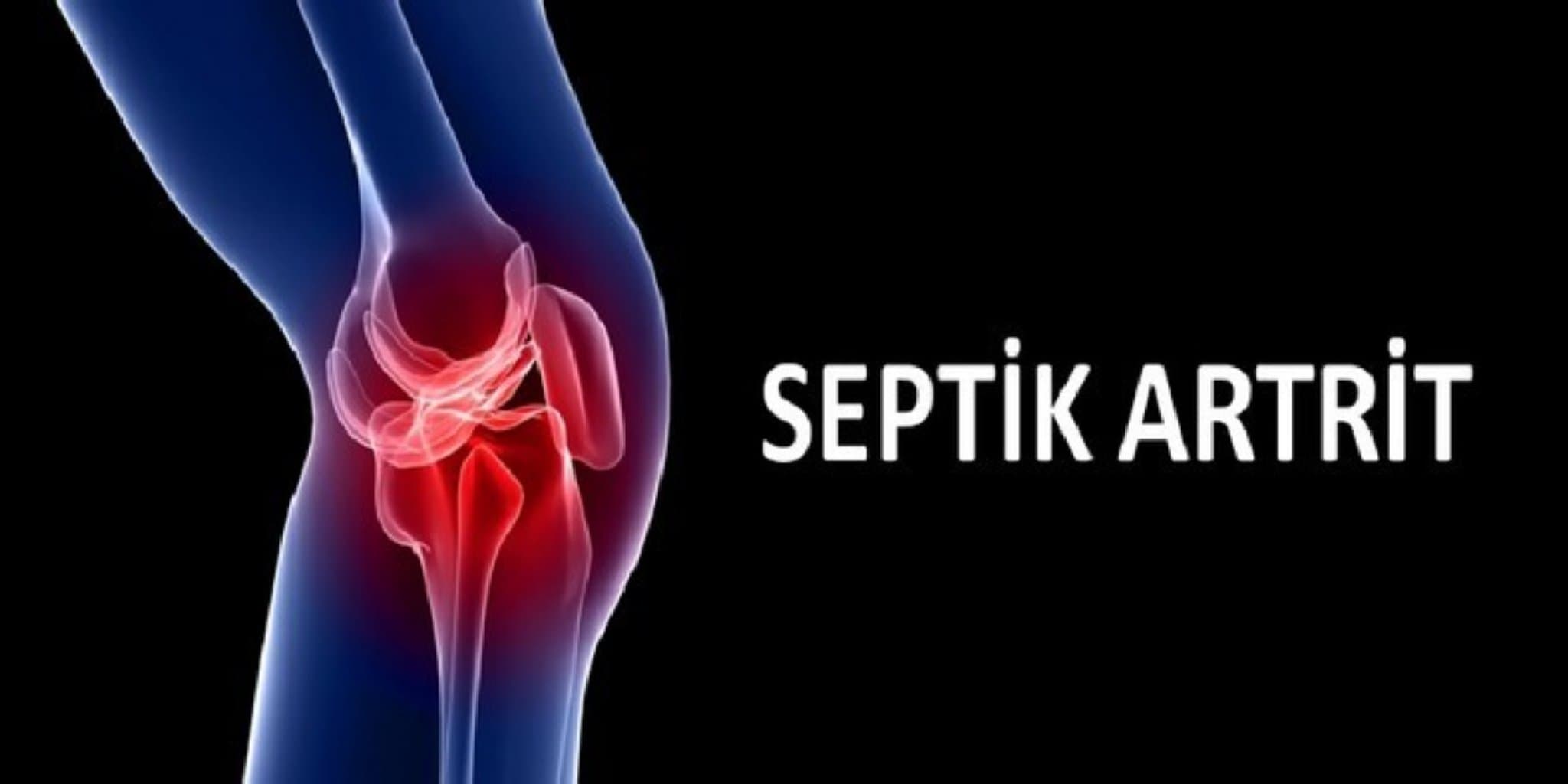 Septik artritlərin konservativ və cərrahi müalicəsi