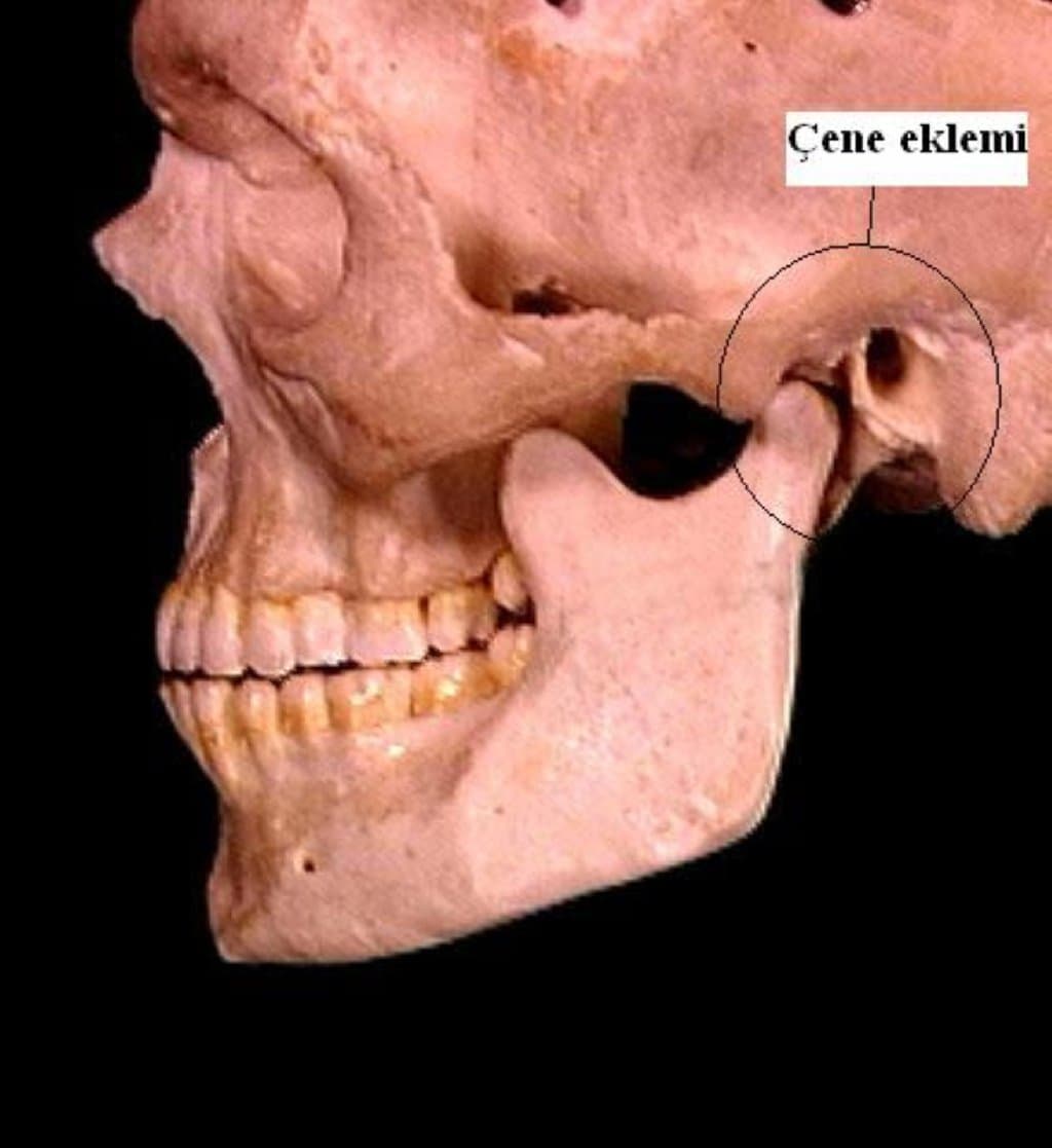 Temporomandibular Eklem (TMJ) xəstəliyi: