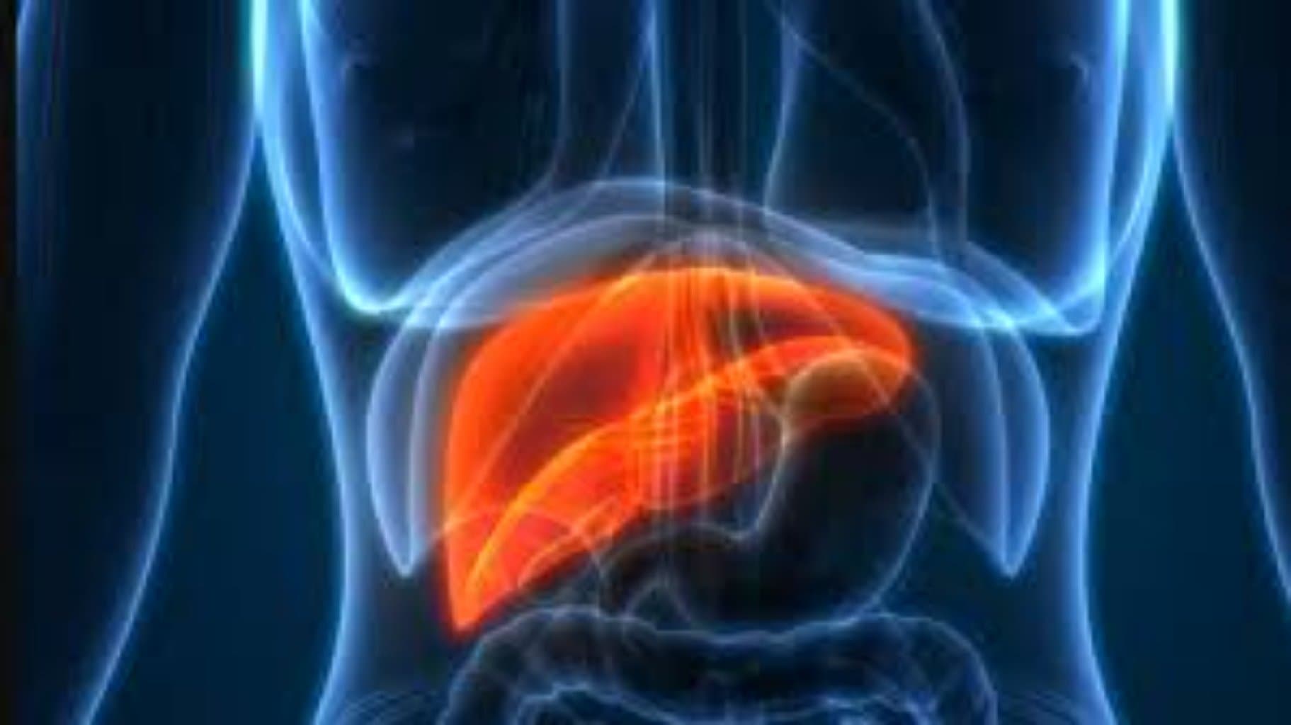 Baddi-Kiari sindromu