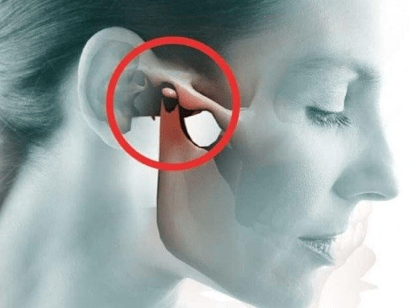 Aşağı çənənin çıxıqları