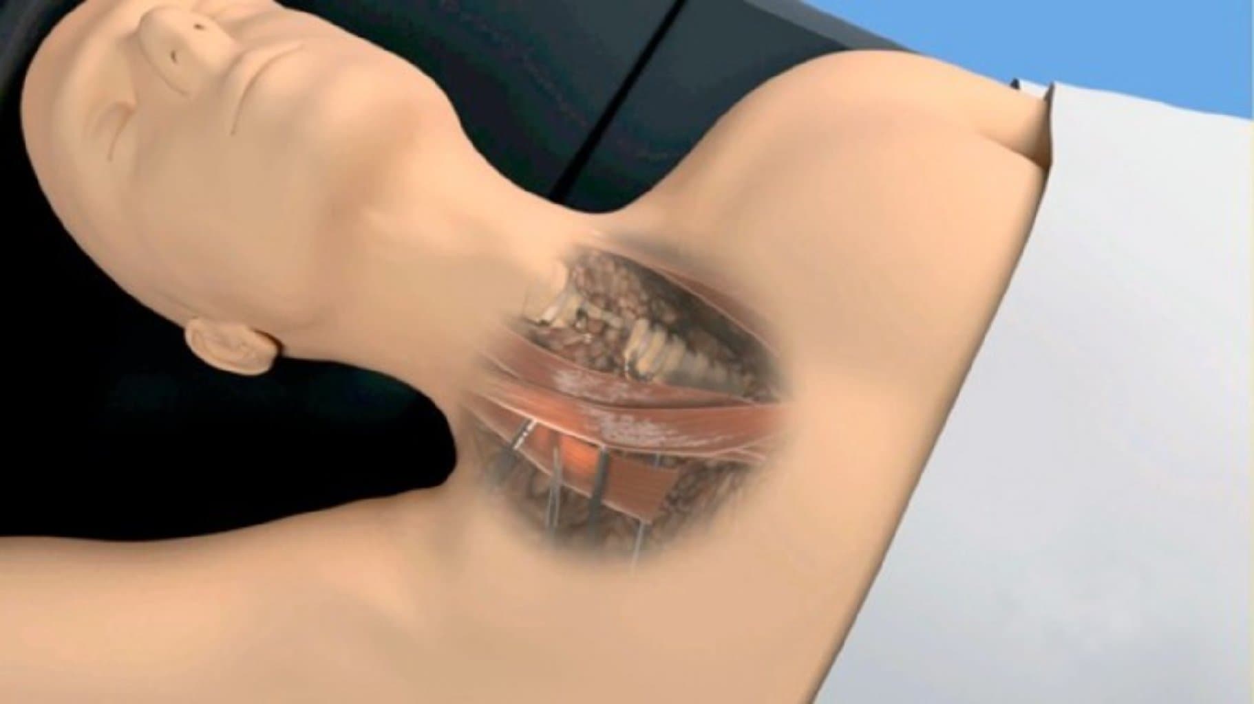 Qalxanvari vəz xəstəlikləri