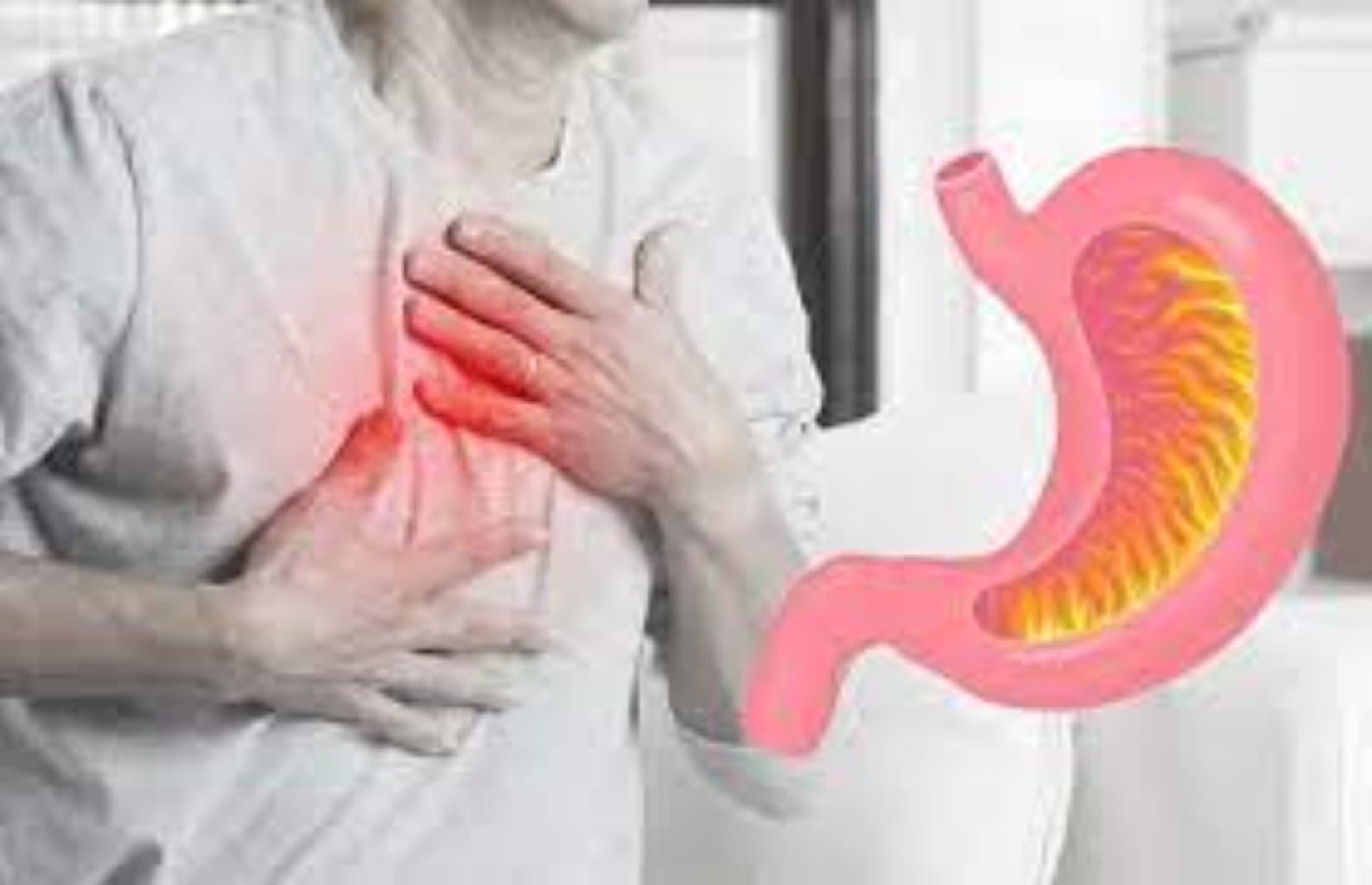 Mədə yanması nədir?