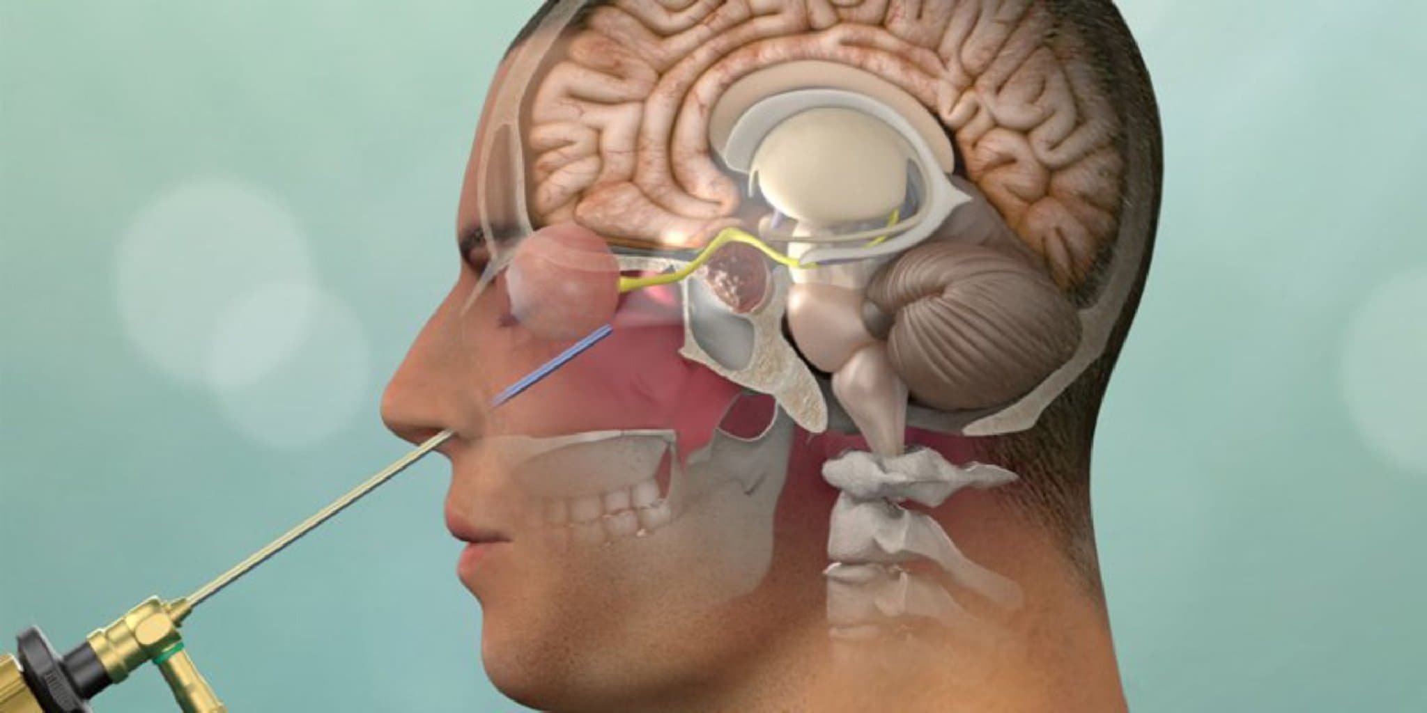 Hipofiz vəz xəstəlikləri