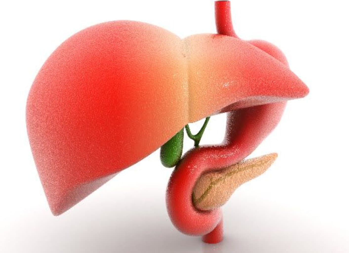 Qaraciyər Hemangioması