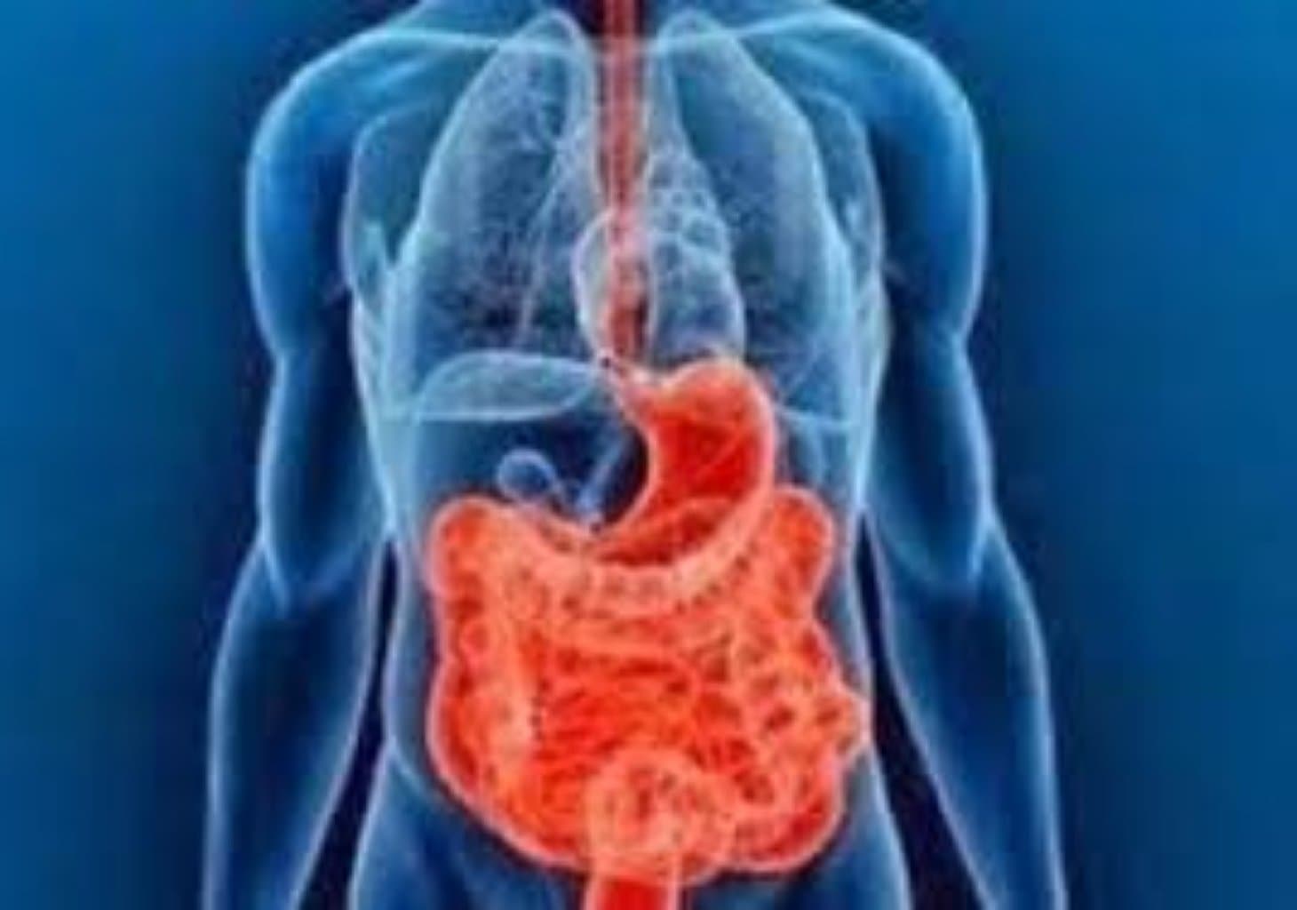 Bağırsaq keçməzliyi