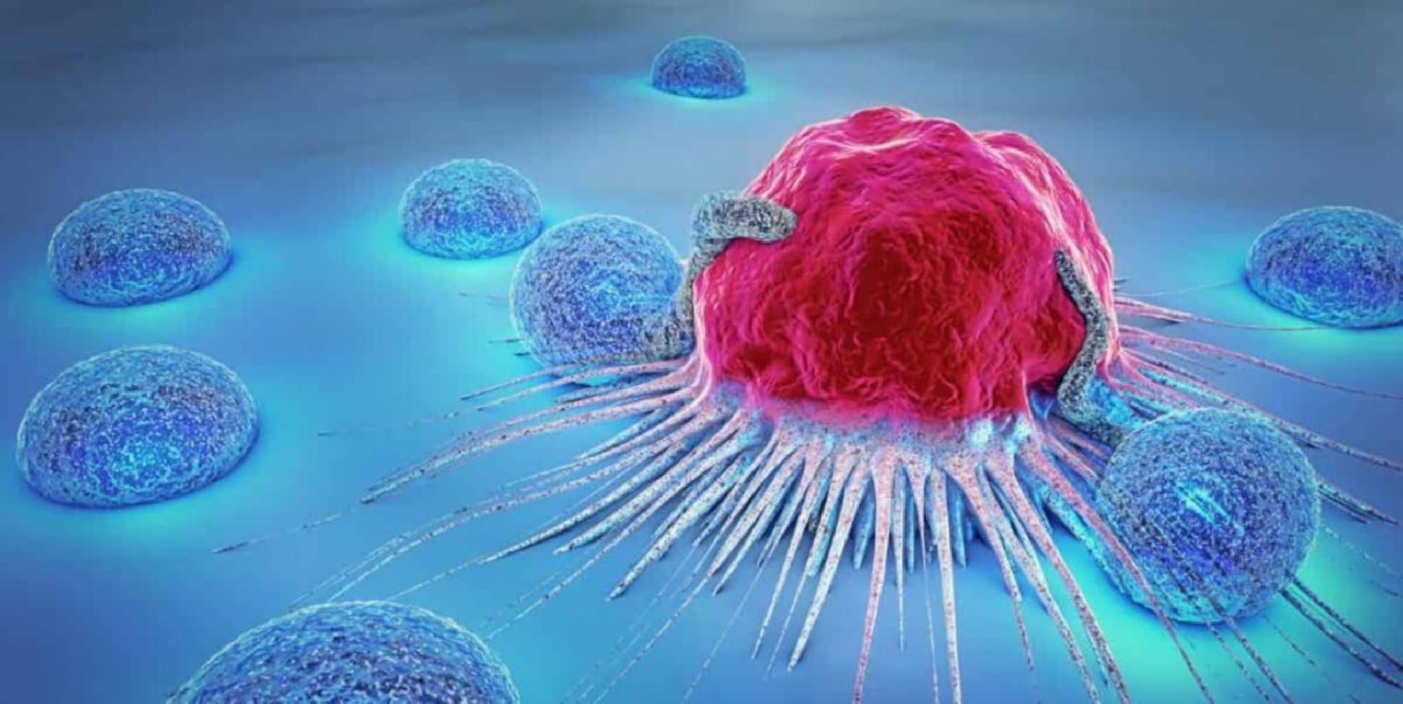 Dəri və yumşaq toxuma şişləri