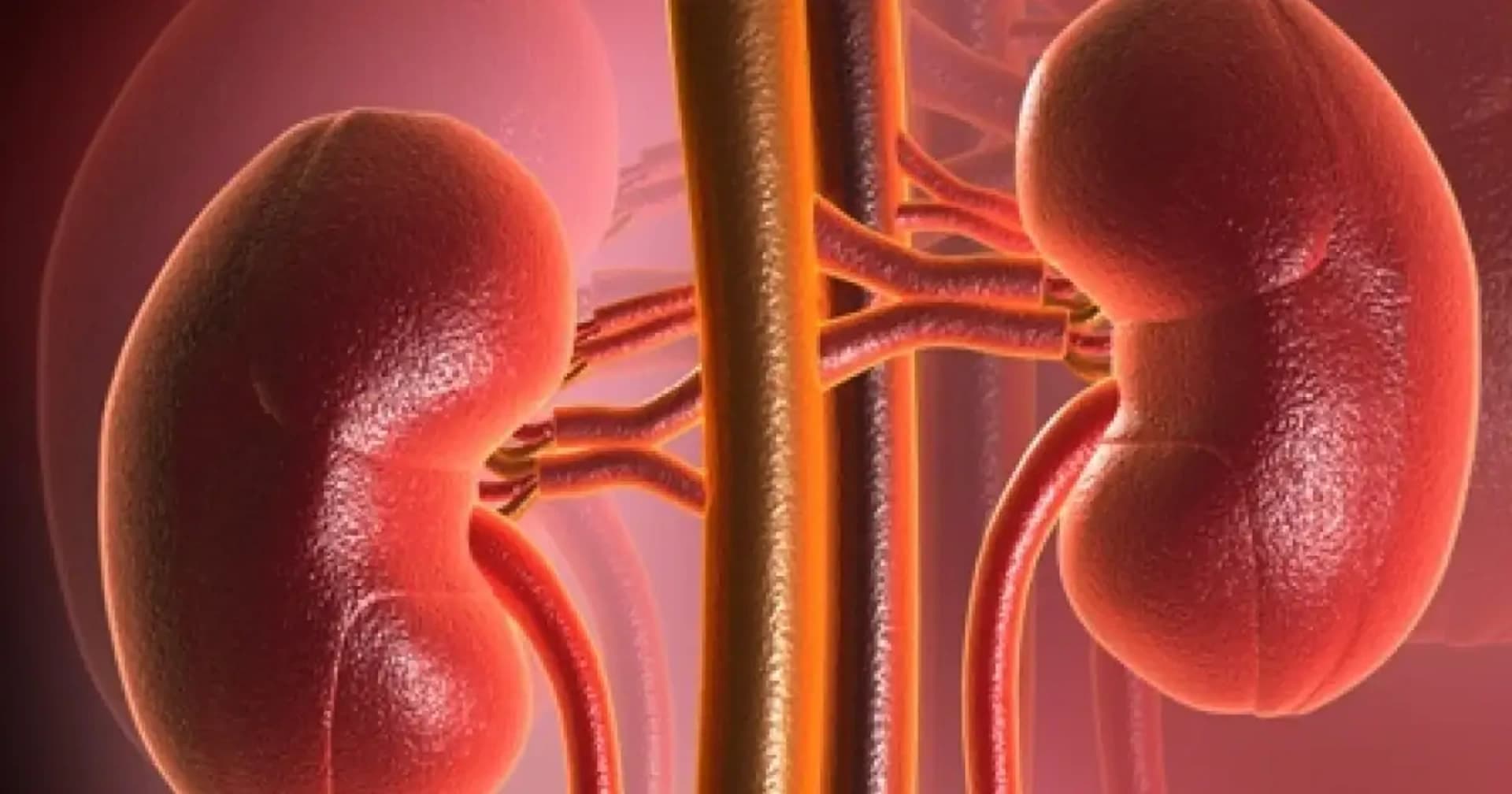 Böyrəklərdən mərcan daşların endoskopik yolla operativ müdaxiləsi