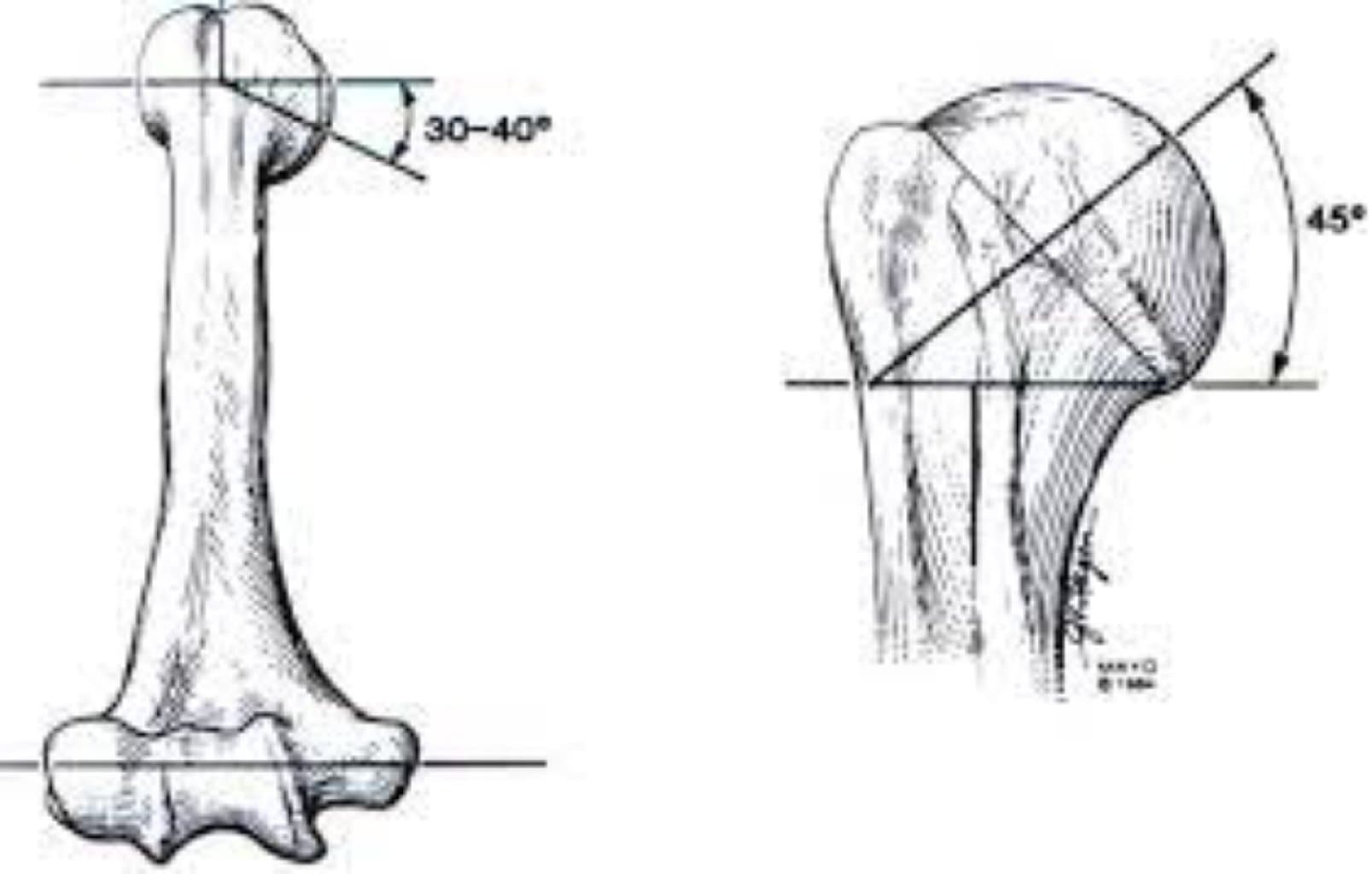 Mikrokristallik artritler