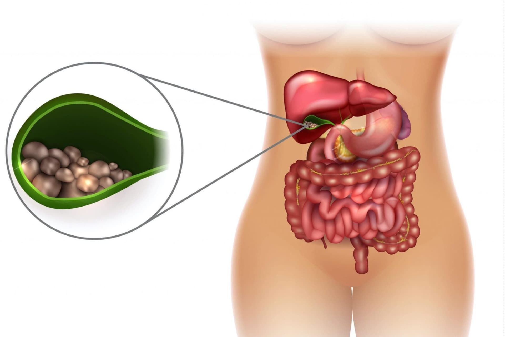 Öd kisəsi: funksiyaları, xəstəlikləri və müalicələri-həzm sağlamlığı üçün bilməli olduğunuz şeylər