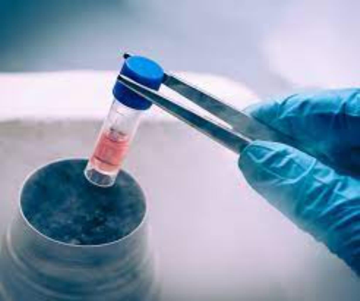 Kök hüceyrə terapiyası