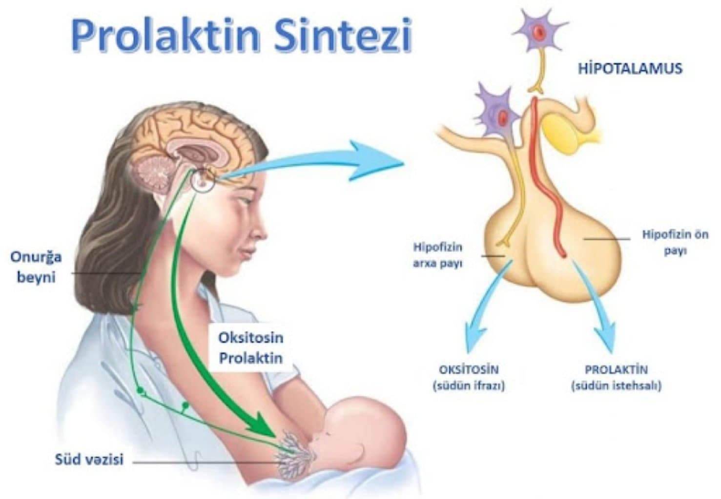 Prolaktin (süd hormonu) hormon yüksəkliyi (PROLAKTİNOMA)