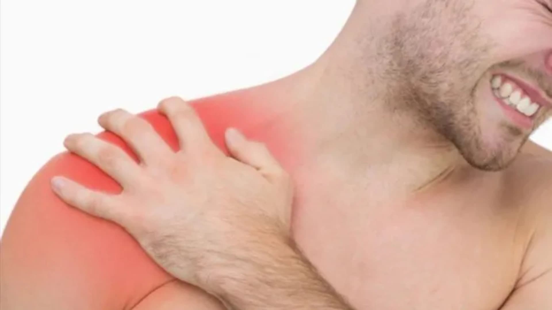 Təkrarlanan Çiyin Çıxığı (Bankart Lezyonu) Cərrahiyyəsi