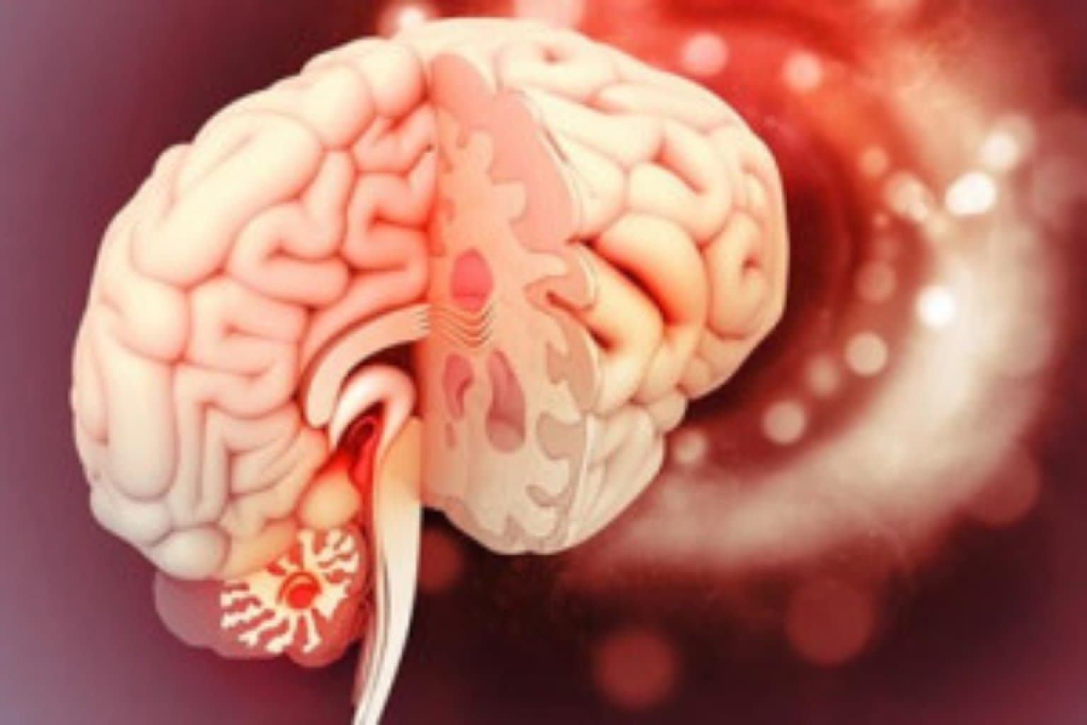 Hipofiz vəzi pozuntusu