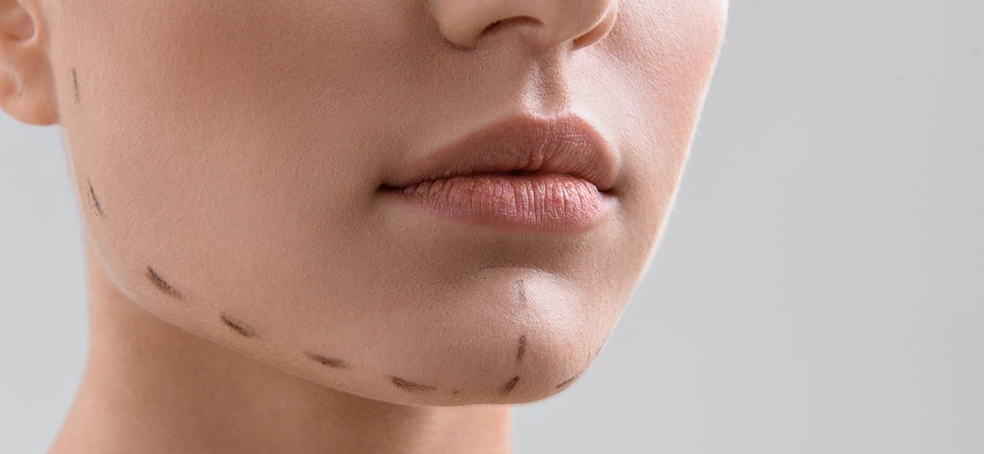 Çənə sahəsinə tətbiq olunan estetik tətbiqlər hansılardır?