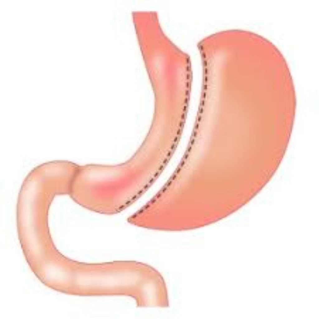 Abdominal əməliyyatların aparılması