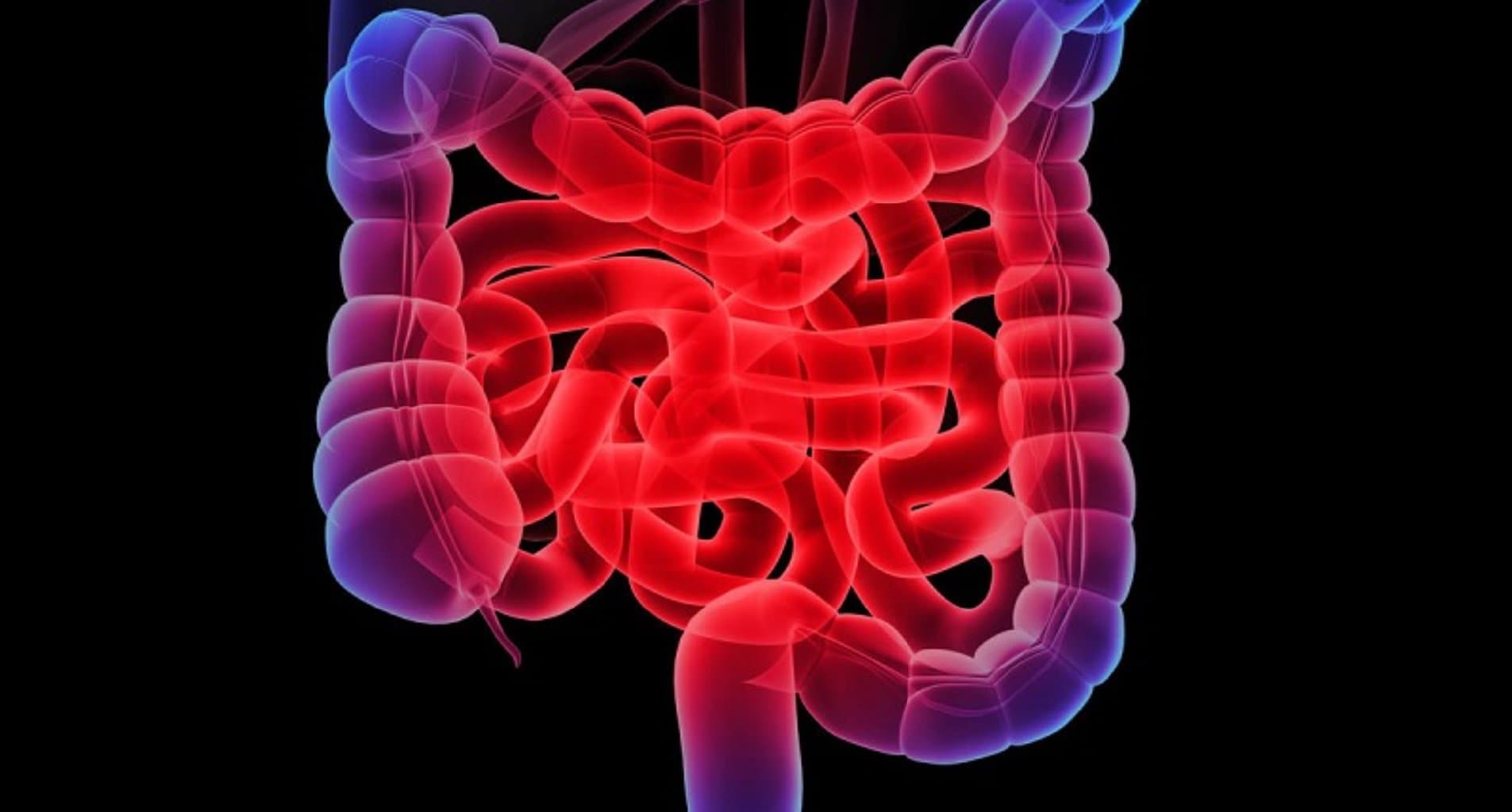 İnfeksion Enterokolitlər