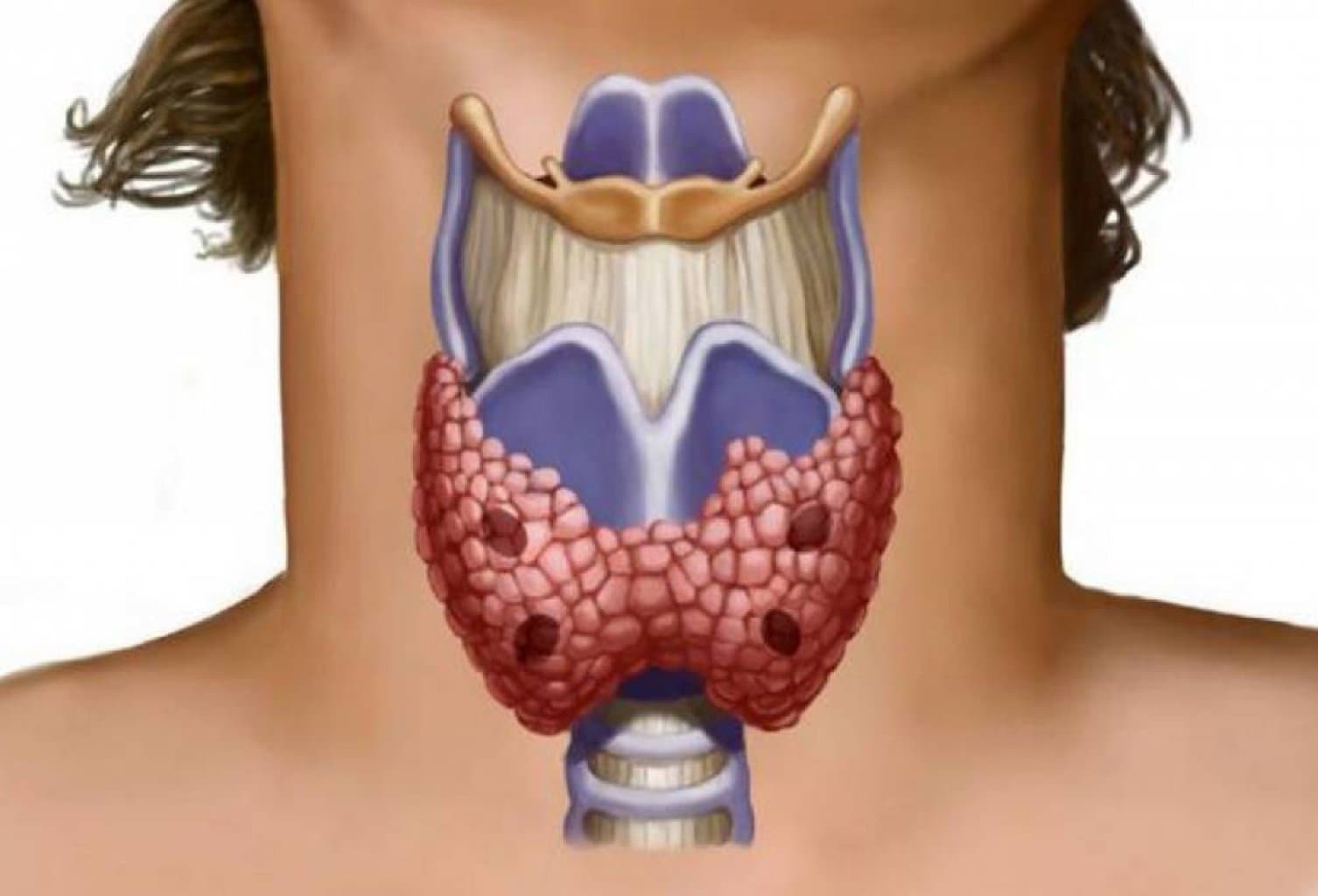 ZOB XƏSTƏLİYİ / ZOB XƏSTƏLİYİNİN ƏLAMƏTLƏRİ / DÜYÜNLÜ UR / QALXANVARİ VƏZİ XƏSTƏLİKLƏRİ