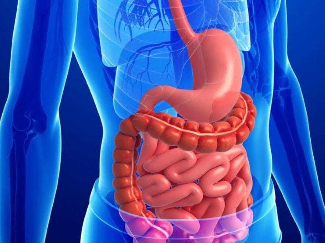 Divertikul xesteliyi