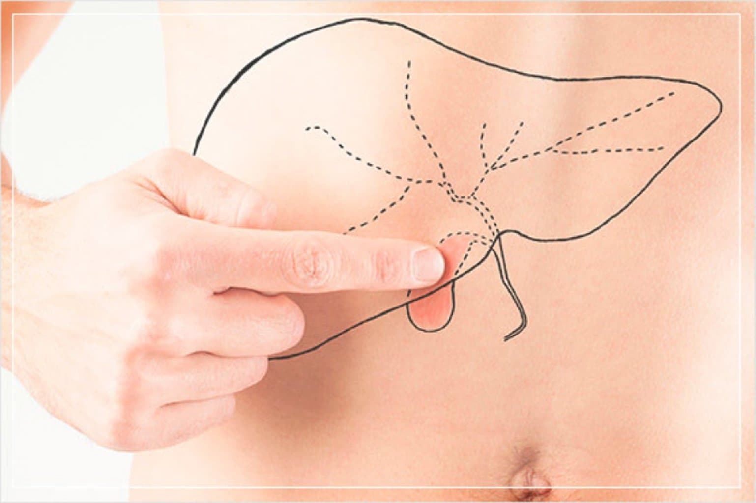 Öd kesesi xəstəlikləri