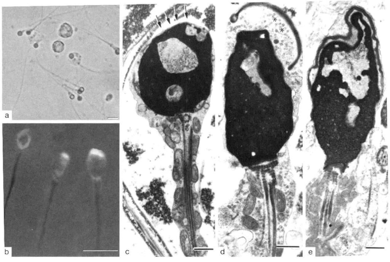 Spermada irin (piospermiya)