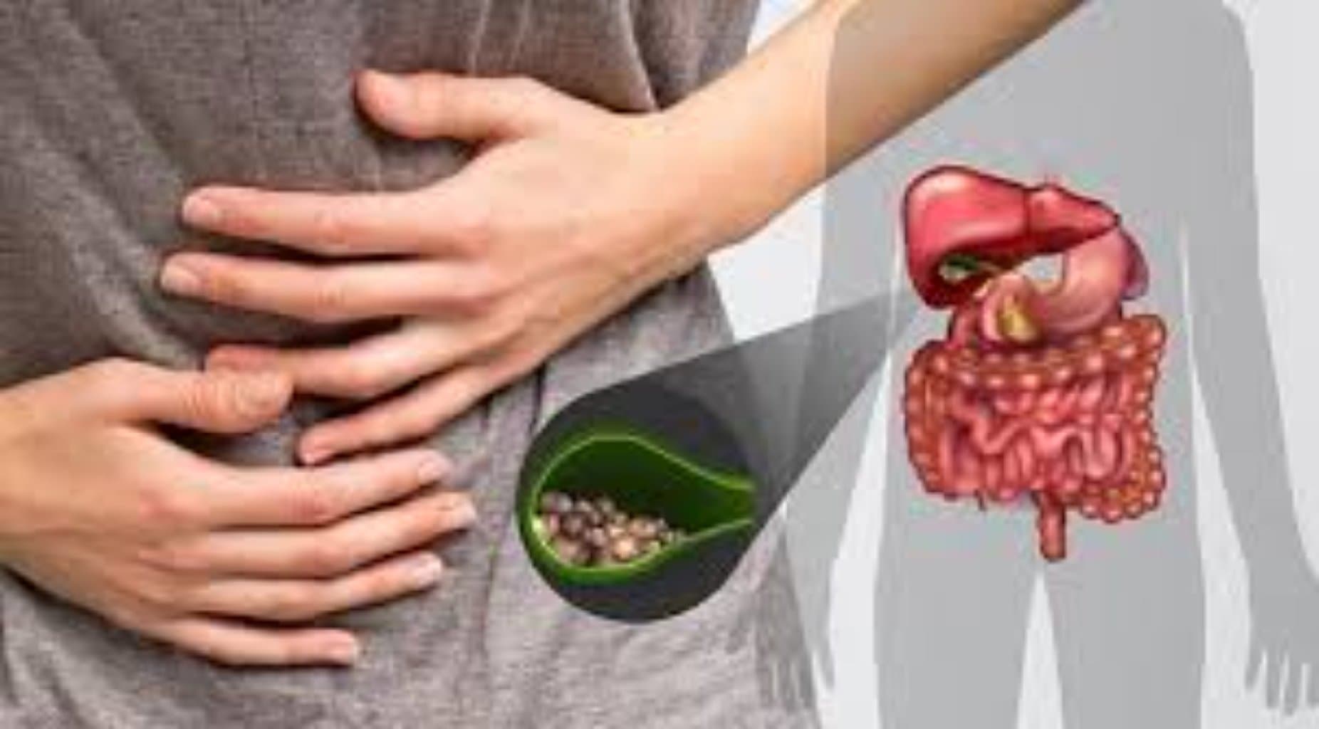 Öd kisəsi diskineziyası