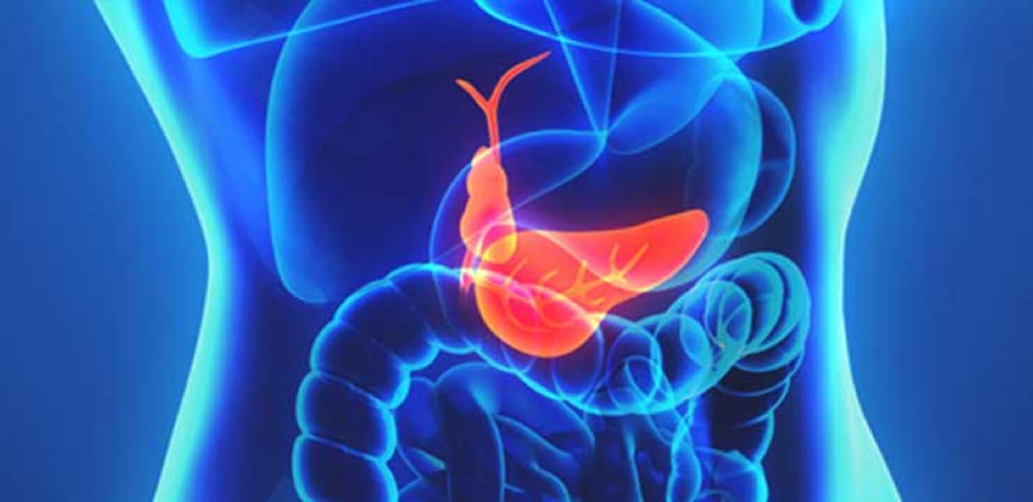 Öd kisəsi polipləri