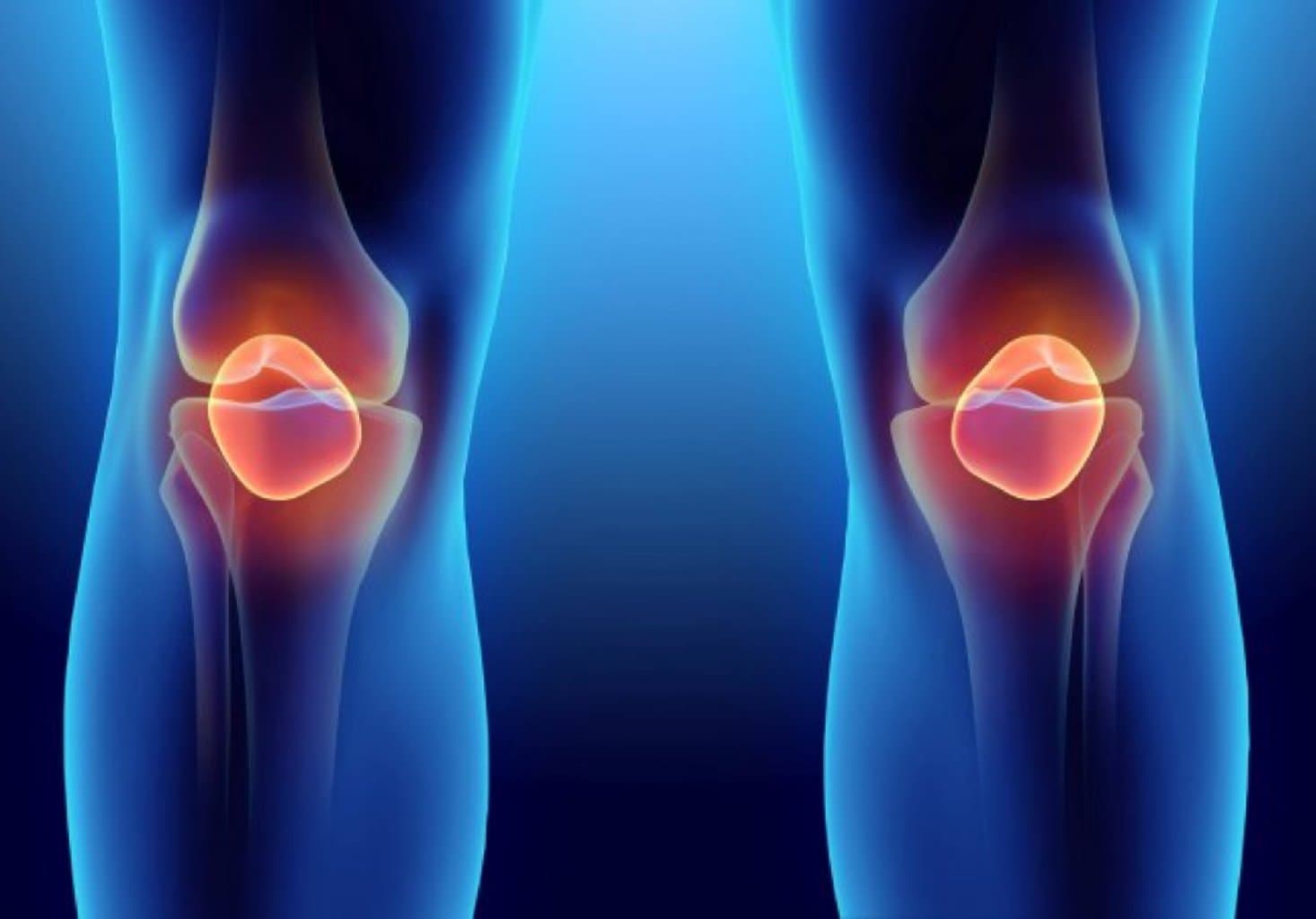 Menisküs əməliyyatı