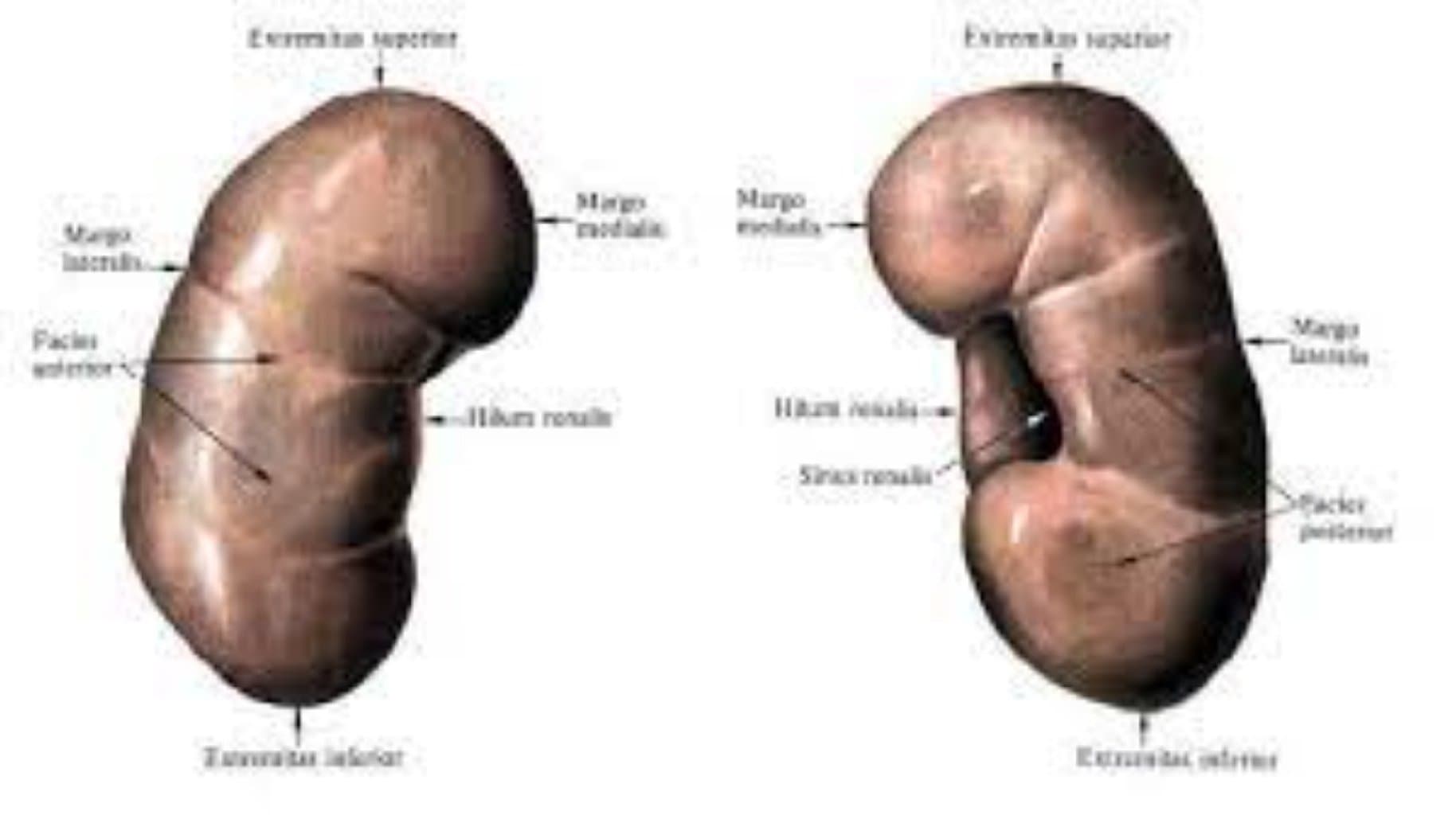 apostematoz pielonefrit