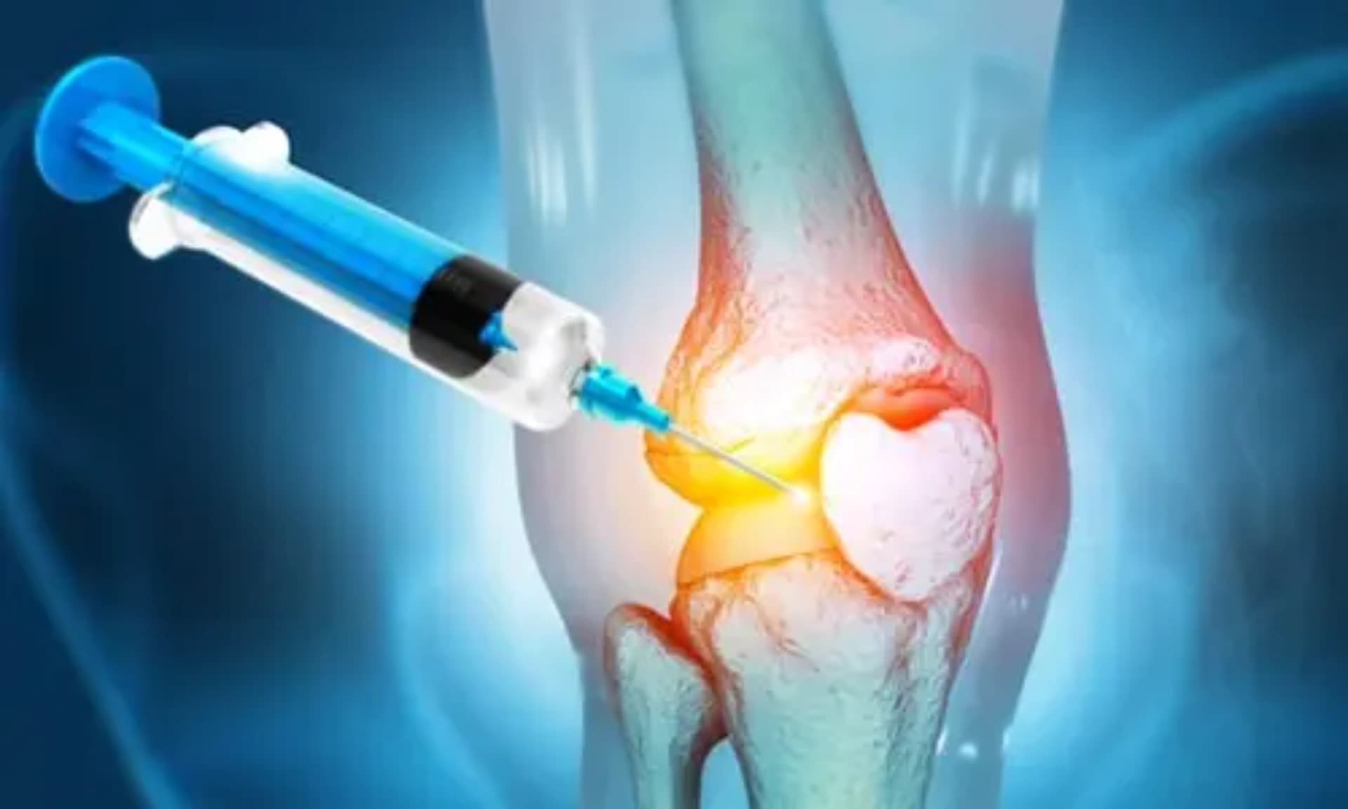 PRP nədir? Hansı xəstəliklərdə tətbiq olunur?