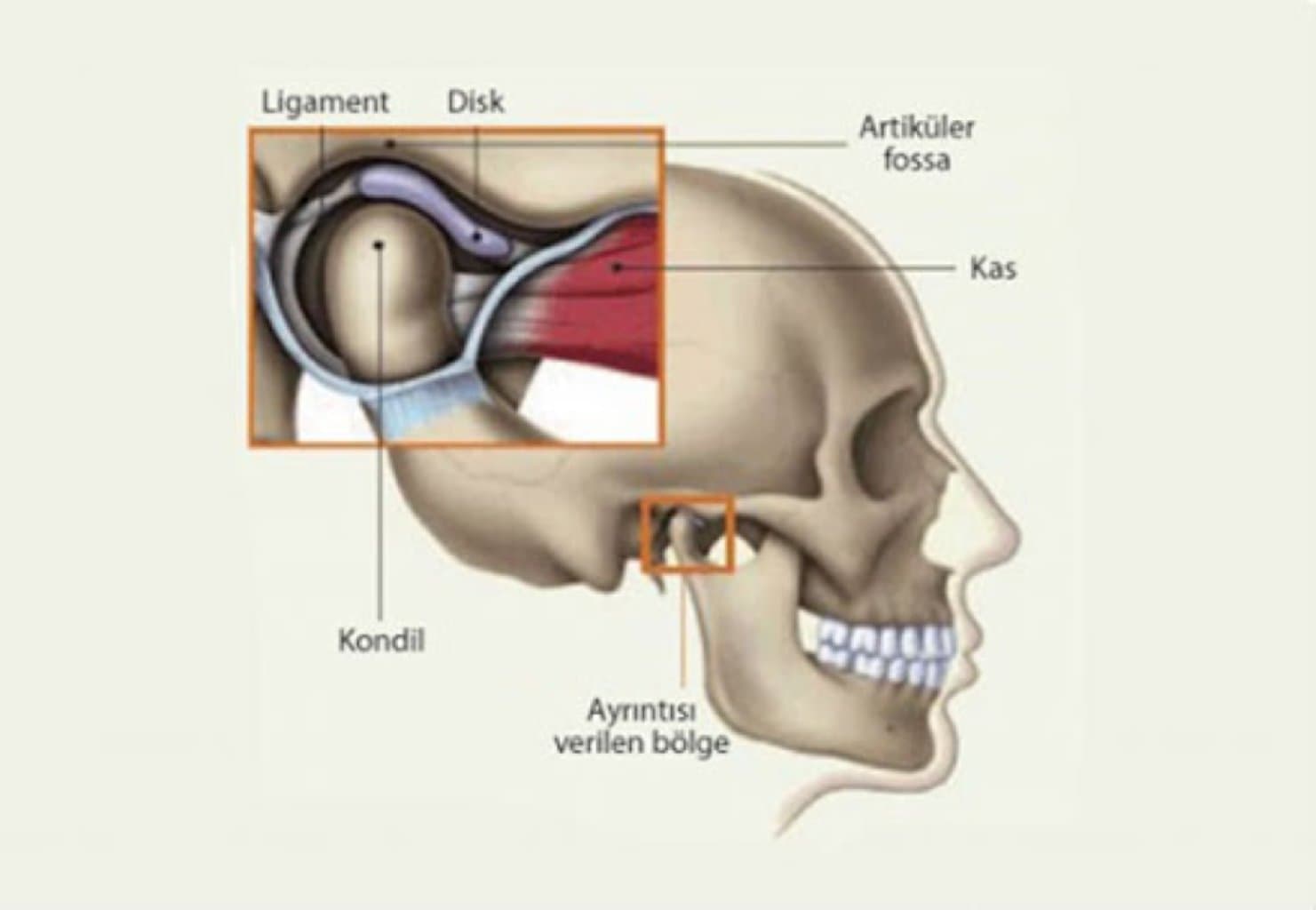 Temporomandibular Oynağın (TMJ) Pozğunluqları: Səbəbləri, Simptomları və Müalicə Yolları