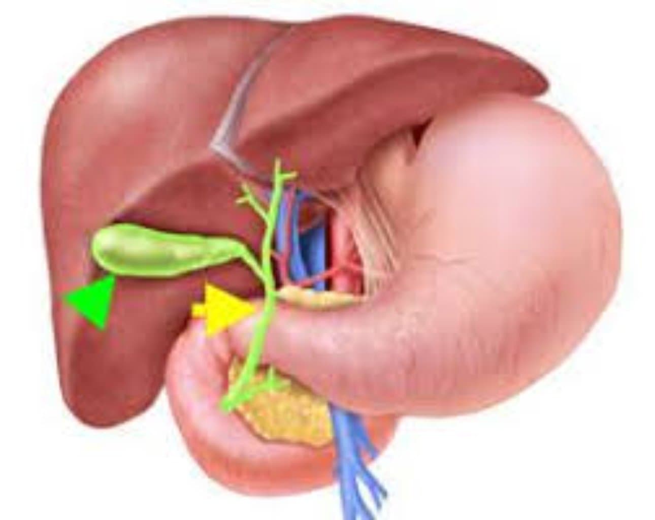 Öd kisəsi xərçəngi
