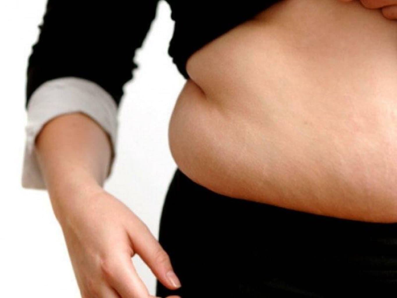 Kuşinq sindromu: simptomlar, səbəblər və müalicə