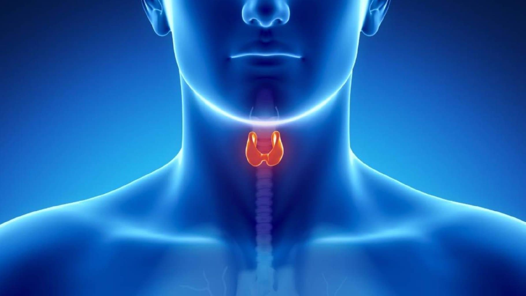 Haşimoto tiroiditi: simptomlar, səbəblər və müalicə
