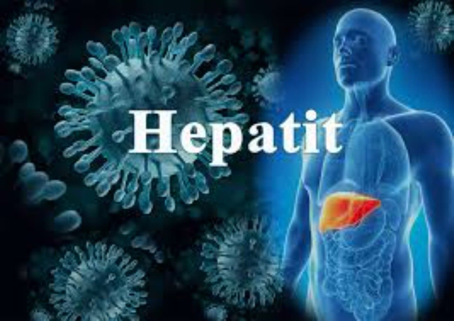 Hepatitlər (virus hepatitləri, alkolik hepatitlər və s.)