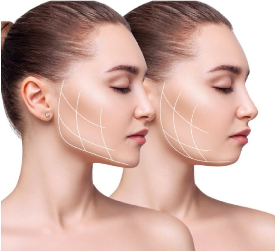 Çənə estetikası və tətbiqi