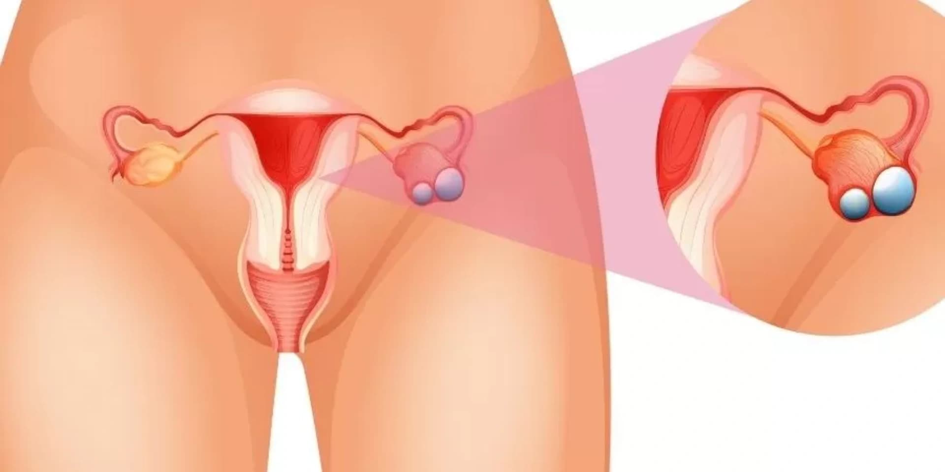 Testis Cərrahiyyəsi