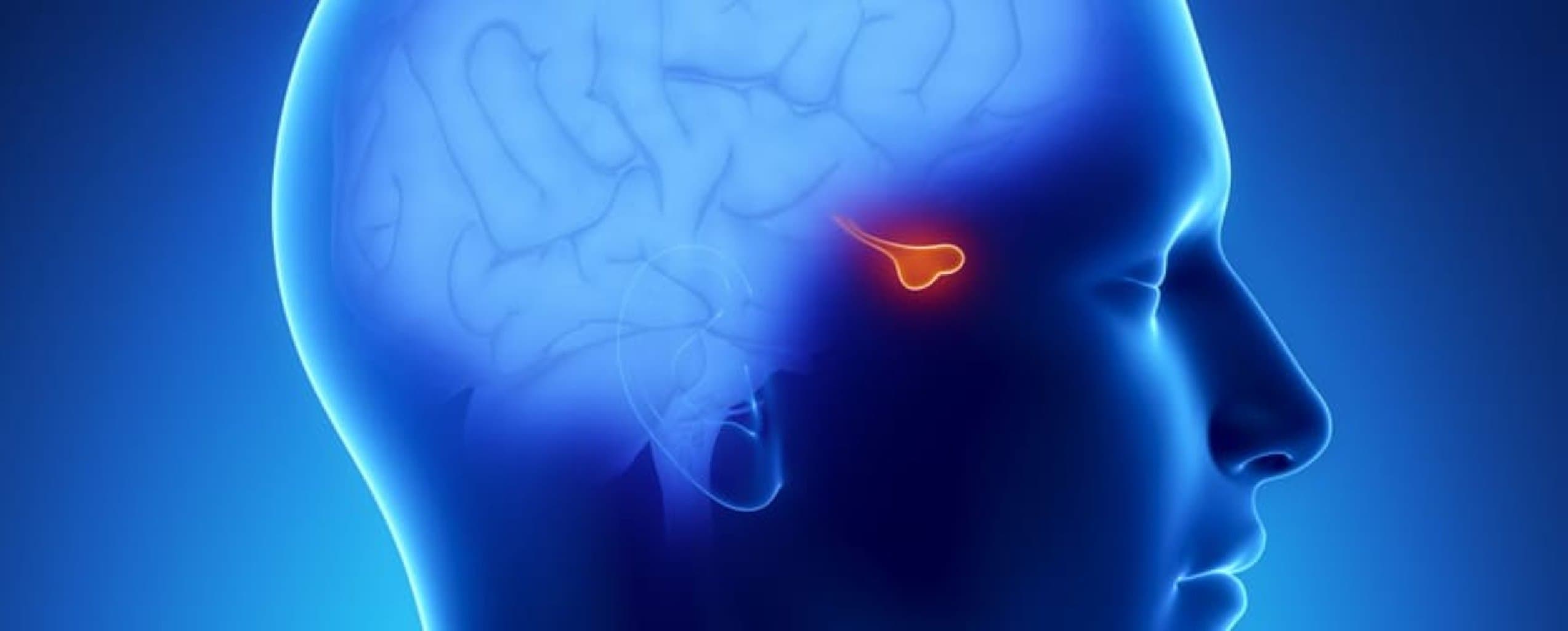 Hipofiz çatışmazlığı, prolaktinin artması