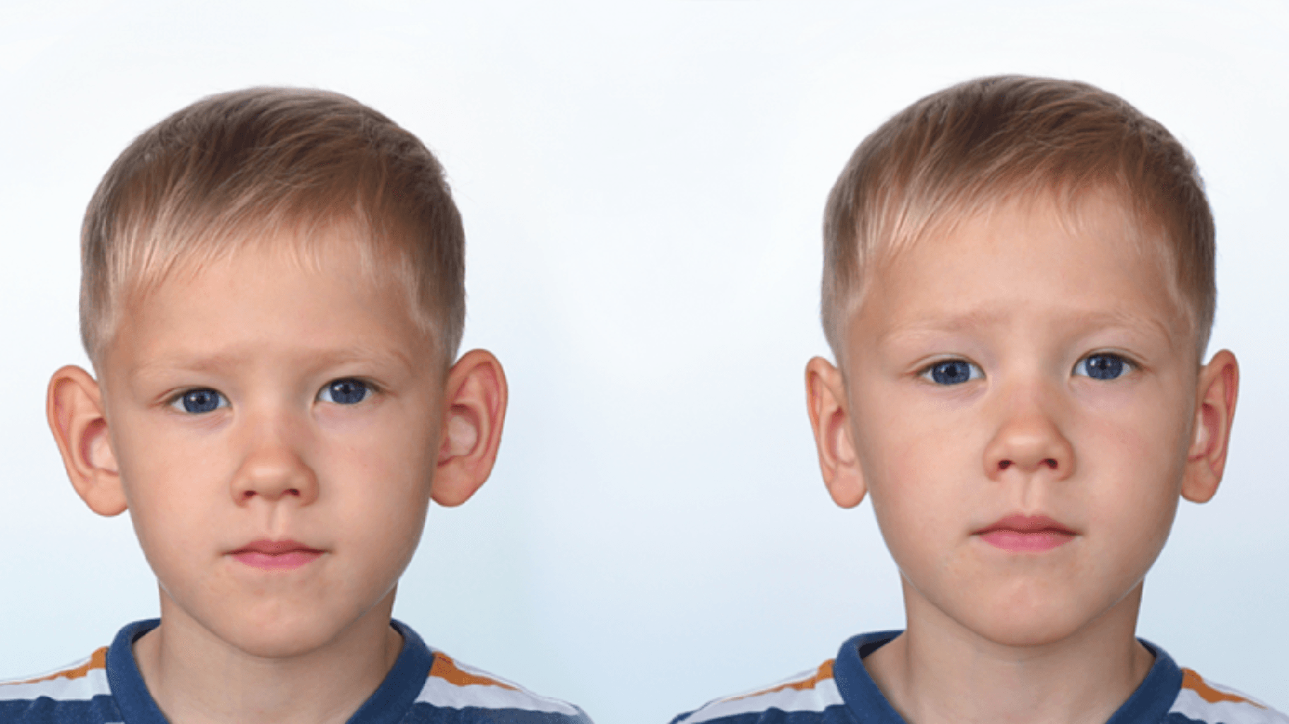 Qulaq Estetikası və Görkəmli Qulaq Problemi