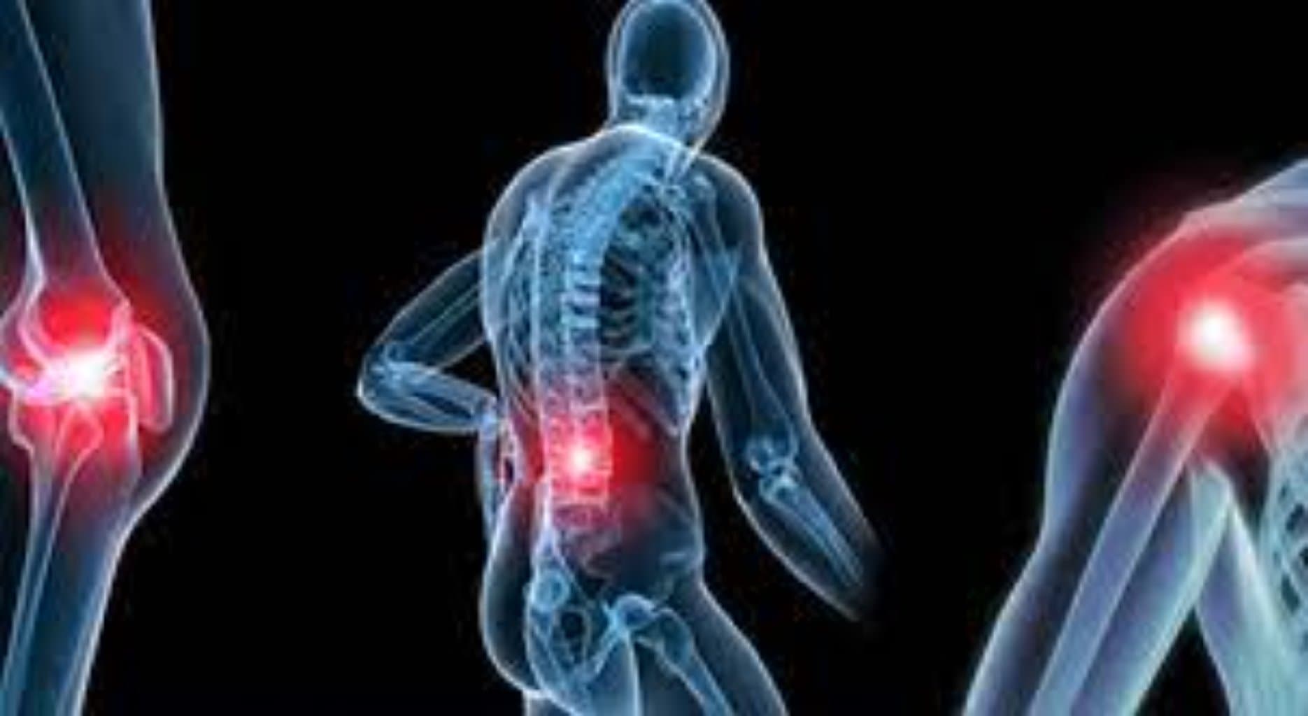 Əhənglənmə (Osteoartrit)