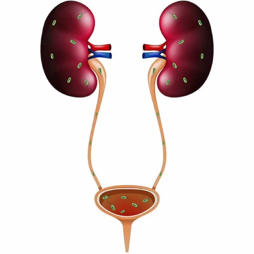 Sidik yollarının infeksiyaları: Ümumi vəziyyət və müalicə variantları