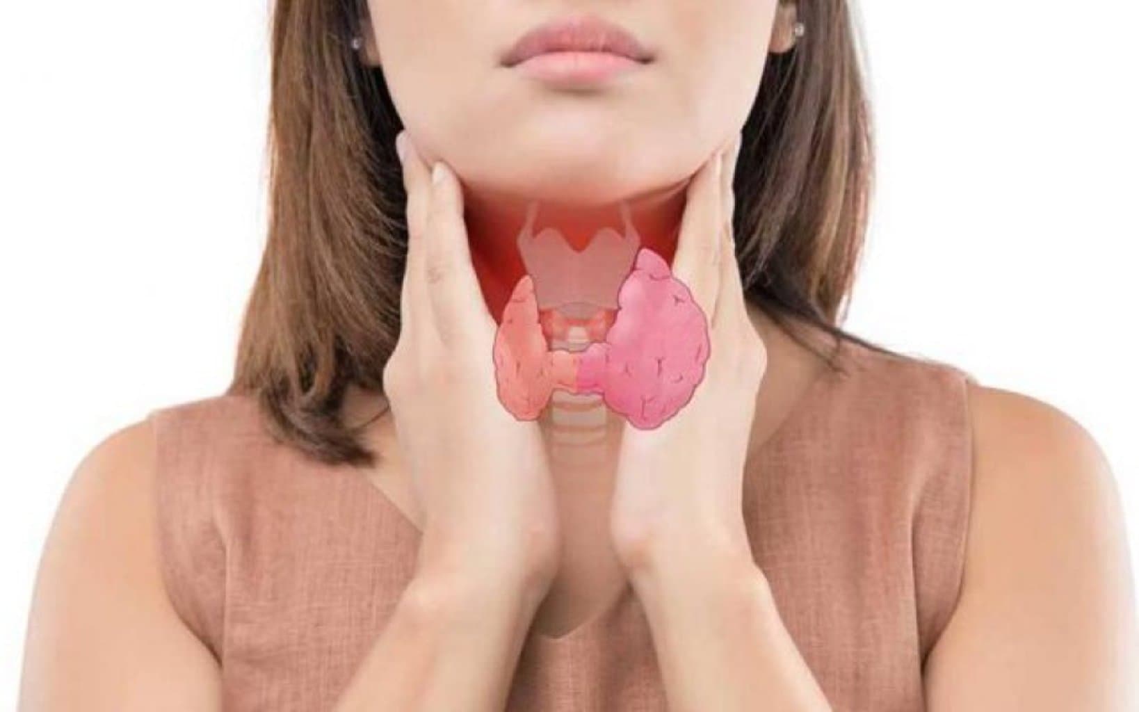 Zob (Tiroid vəzi böyüməsi)