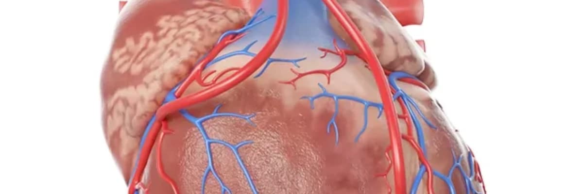 Koronar bypass əməliyyatı