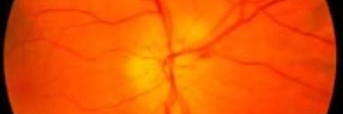 NEYRO-OFTALMOLOGİYA