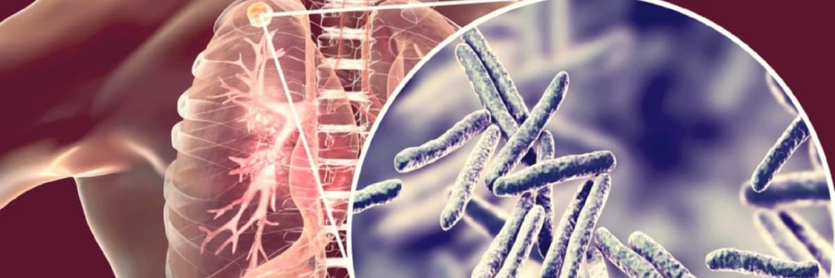 Vərəm (Vərəm) haqqında