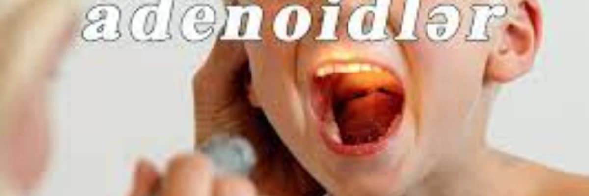 Usaqlarda adenoidit
