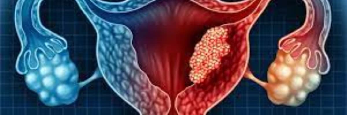 Yumurtalıq Xərçənginin Səbəbləri və Risk Faktorları